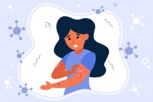 hypersensitivity