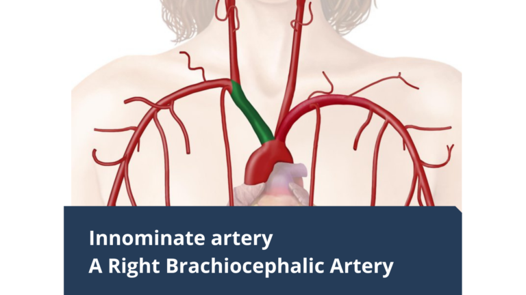 Innominate Artery- A Right Brachiocephalic Artery - Daily Medicos